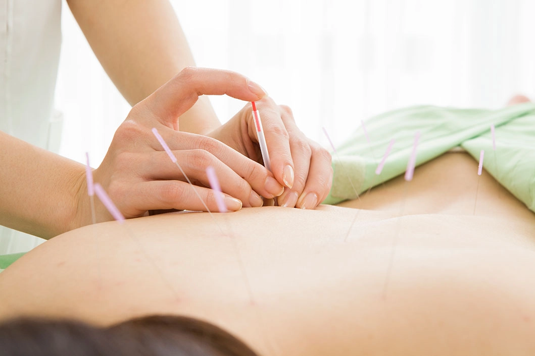 Signs of Acupuncture Treatment is Effective